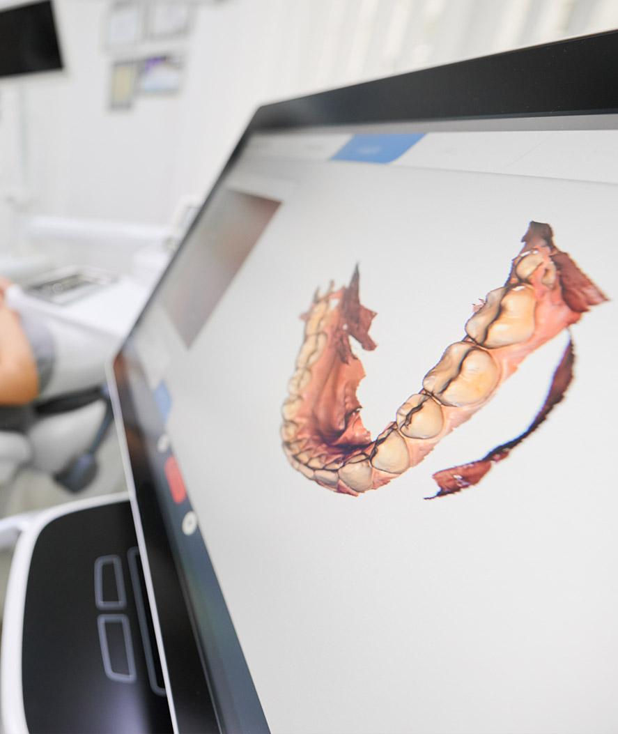 digital dental technology
